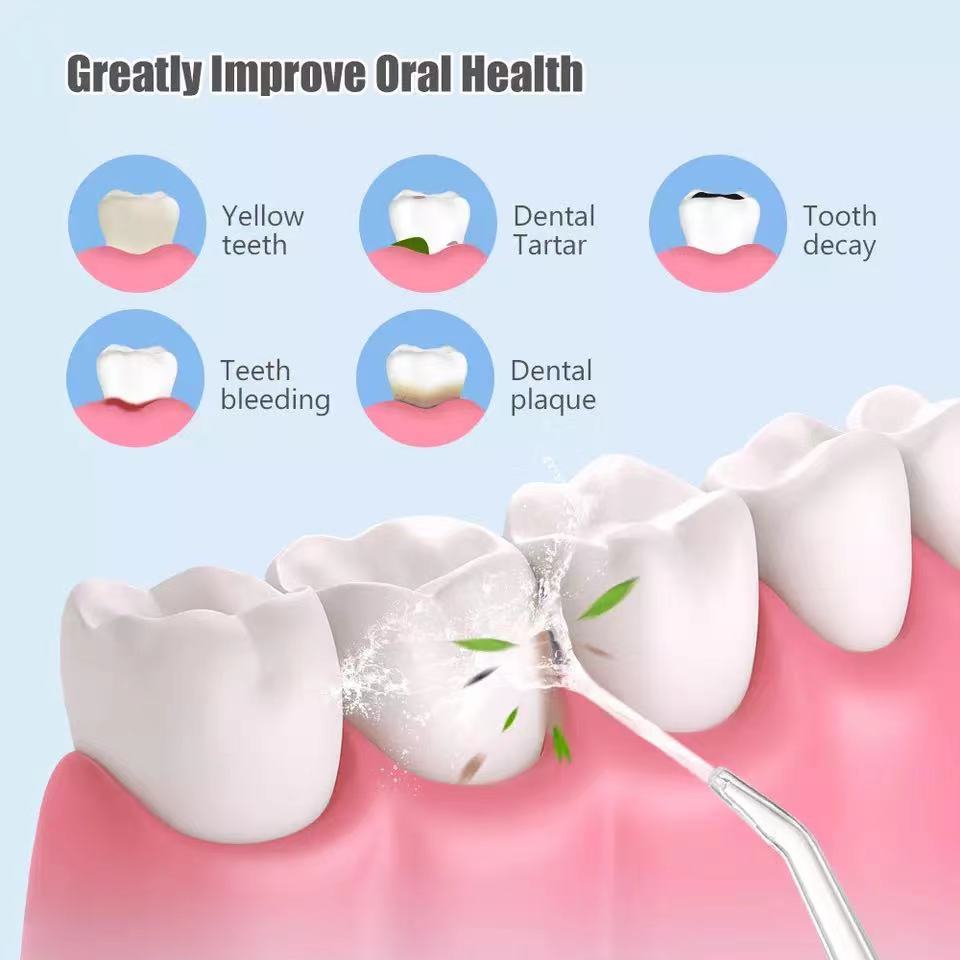 Waterproof Irrigator Dental Cleaner – Portable Oral Water Flosser